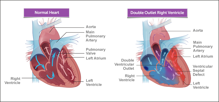 Normal Heart Anatomy and Blood Flow - Pediatric Heart Specialists