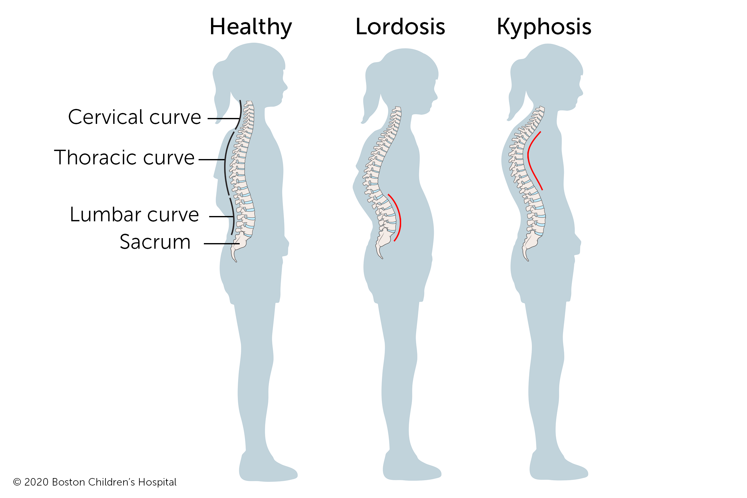 Curves Of The Spine Human Vertebral Column Anatomy Pr - vrogue.co